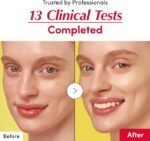 EQQUALBERRY Vitamin Illuminating Serum | Niacinamide 4% + Brightening Vitamin C Face Serum with Hyaluronic Acid & Vitamin E | Dark Spot, Uneven Tone Care | Korean Skincare, 1.01 fl.oz