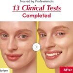 EQQUALBERRY Vitamin Illuminating Serum | Niacinamide 4% + Brightening Vitamin C Face Serum with Hyaluronic Acid & Vitamin E | Dark Spot, Uneven Tone Care | Korean Skincare, 1.01 fl.oz